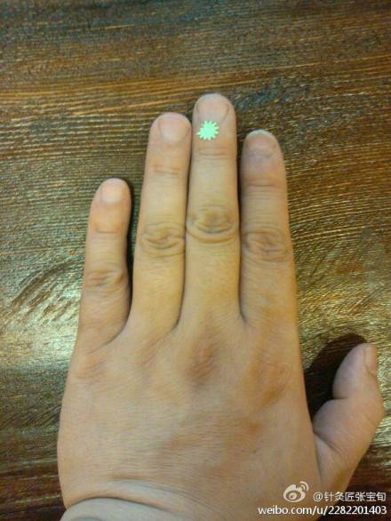 ��Ľ��ű�Ѯ����ҽѧ�ط����ܼ򵥣���Ч��! - Եˮ���� - 