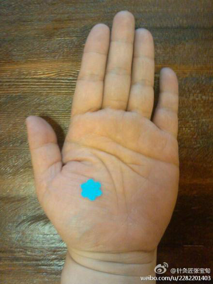 ��Ľ��ű�Ѯ����ҽѧ�ط����ܼ򵥣���Ч��! - Եˮ���� - 