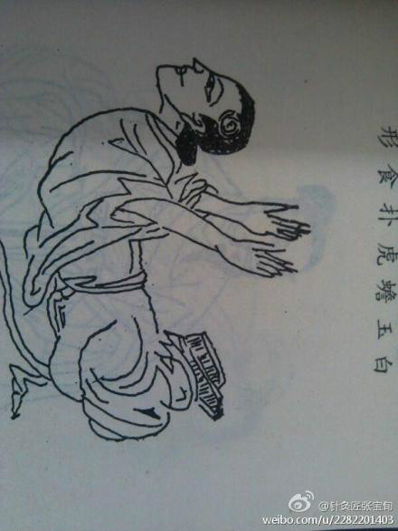 针灸匠张宝旬健康医学秘方,很简单,有效果! - 缘水禅心 -